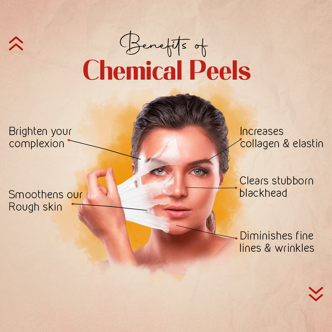Chemical Peels DP